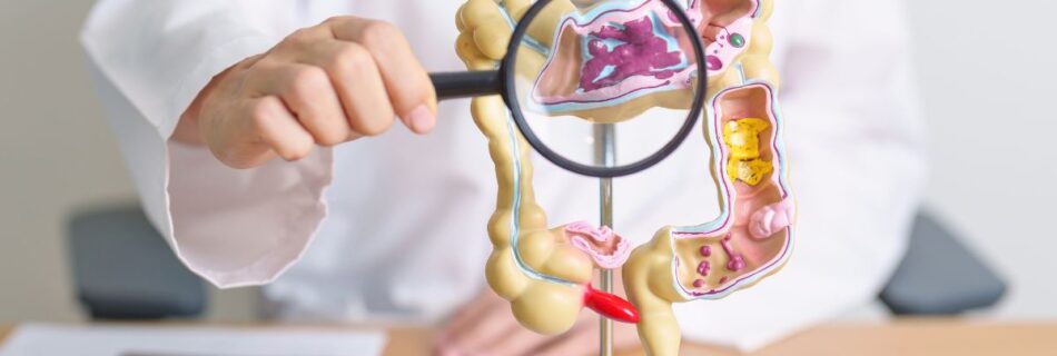 Librax: Uso em Úlceras e Síndrome do Intestino Irritável