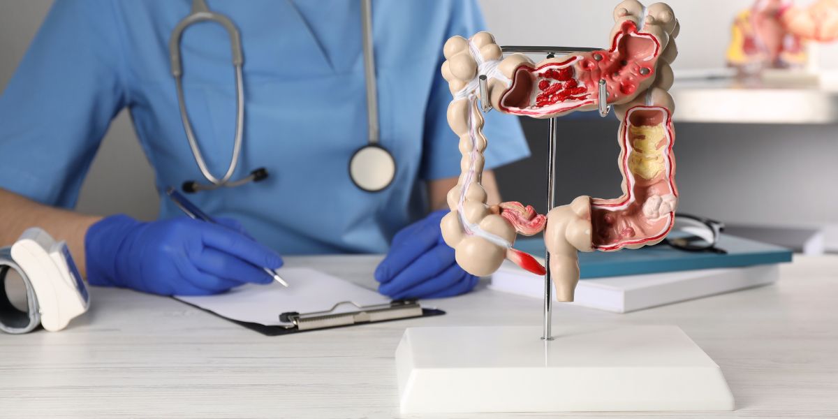 Prevenção e Tratamento do Cancro do Cólon em Portugal