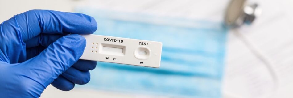 Teste Serológico à COVID-19: Importância e Funcionamento